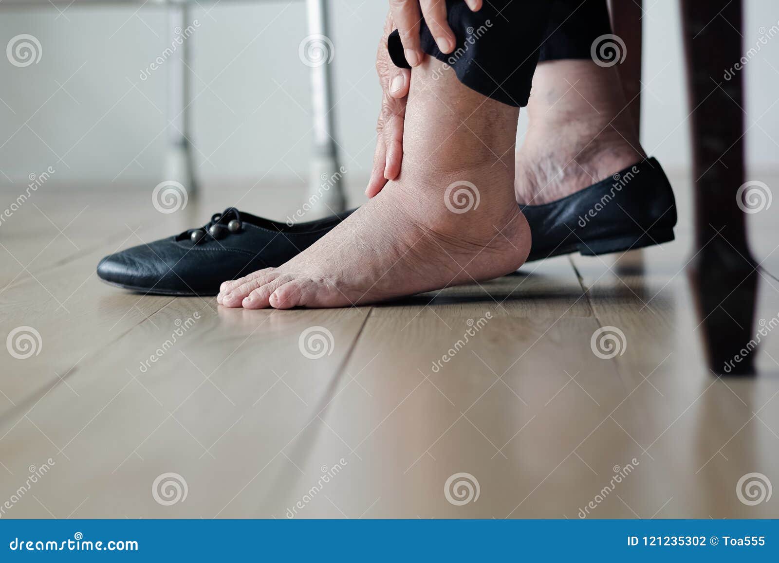 elderly woman swollen feet putting on shoes