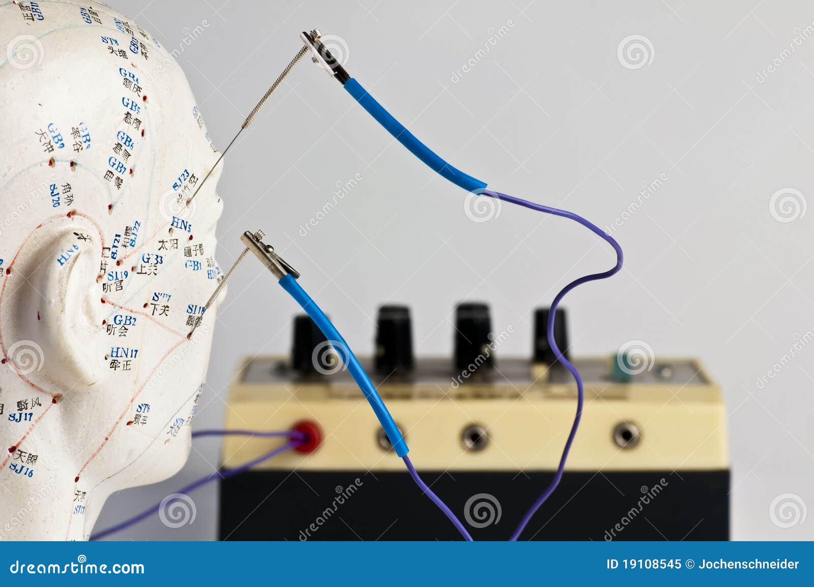 Electricacupuncture stock image. Image of chinese, color 19108545