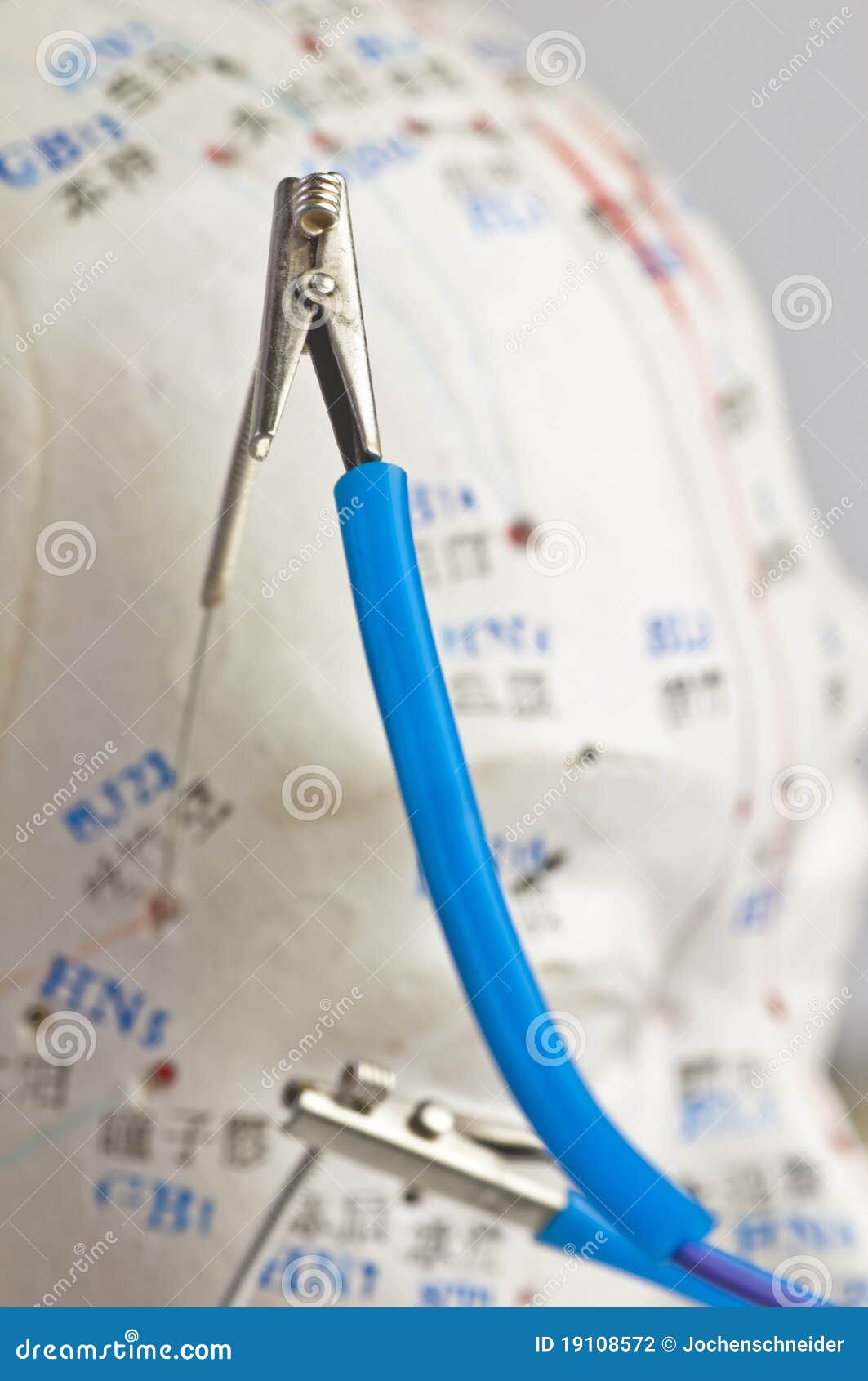 Electricacupuncture stock photo. Image of front, color 19108572