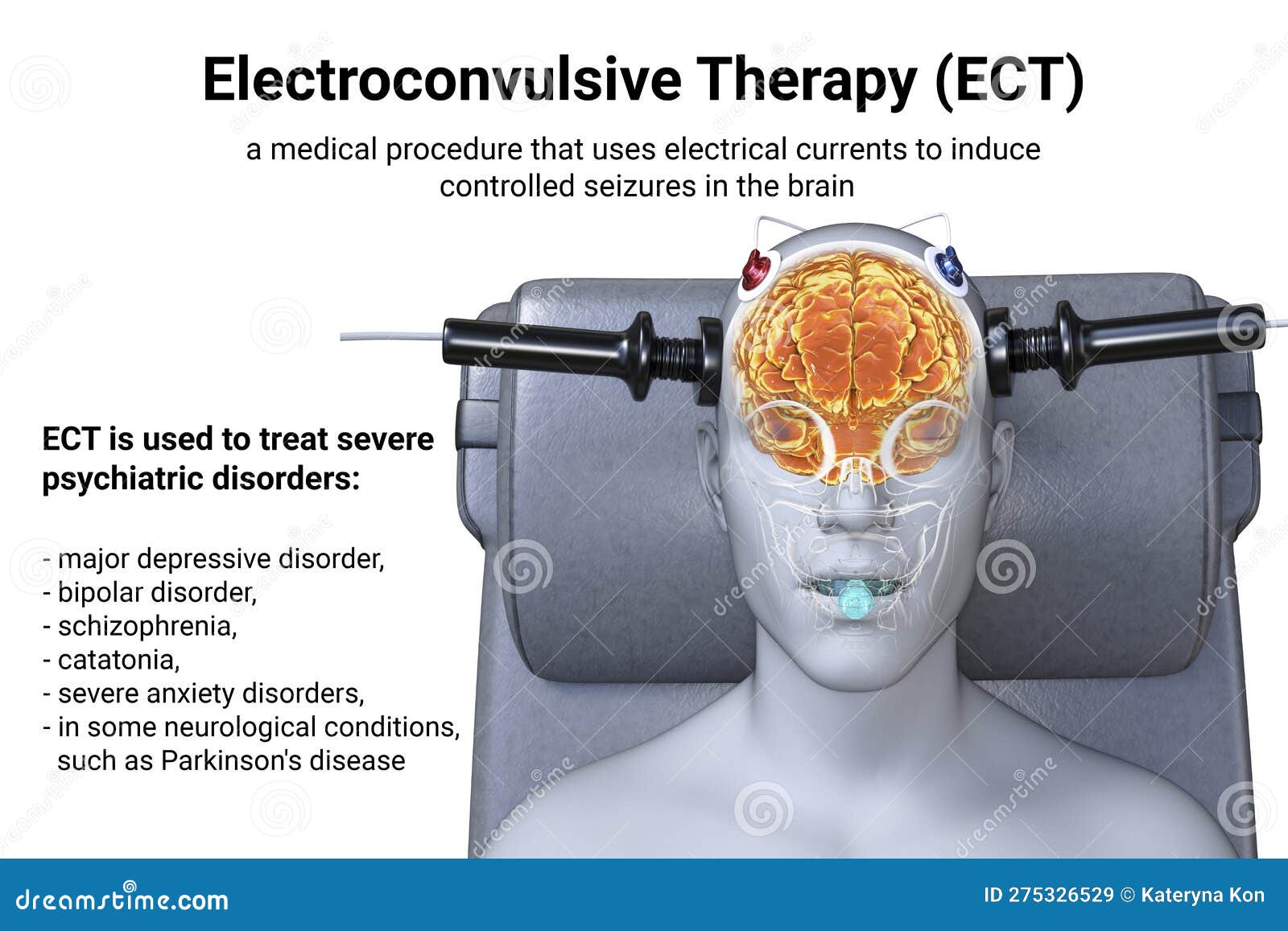 thesis on electroconvulsive therapy