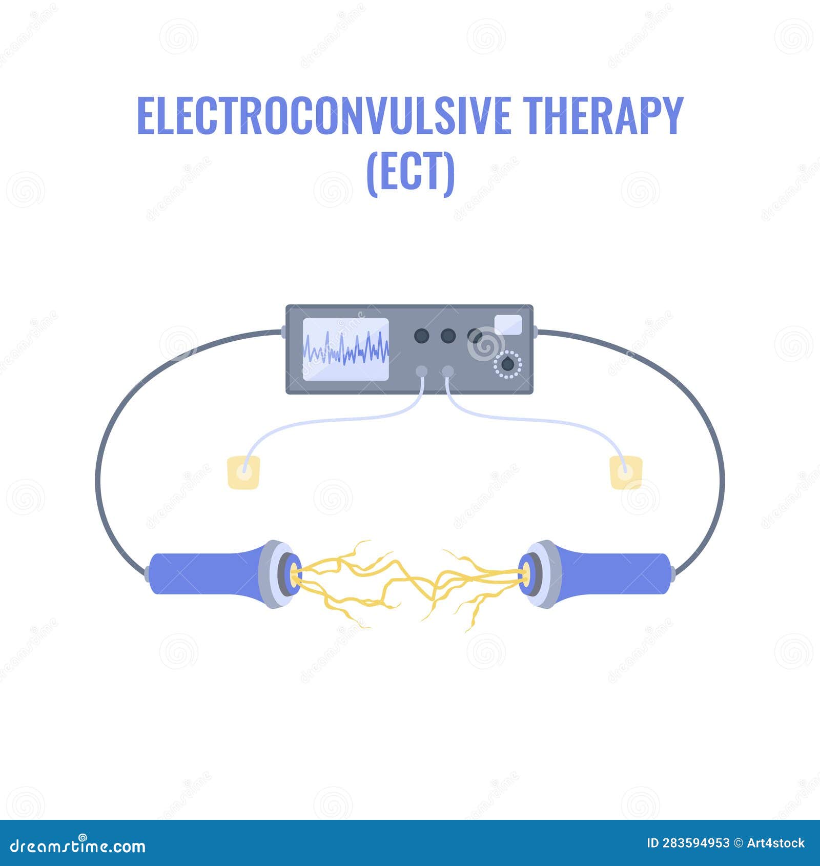 ECT Electroconvulsive Therapy for Severe Depression Treatment Stock