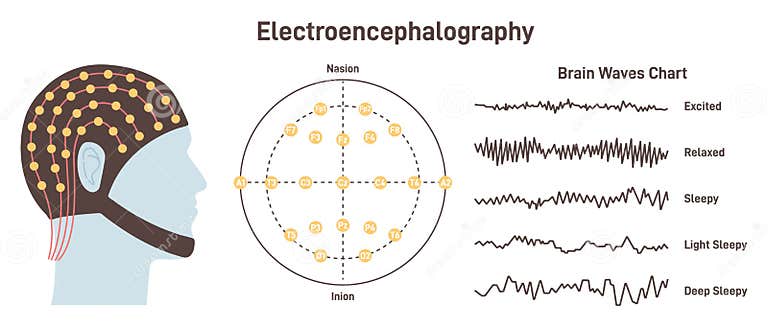 Electroencephalography. Medical Test that Measures Electrical Activity ...