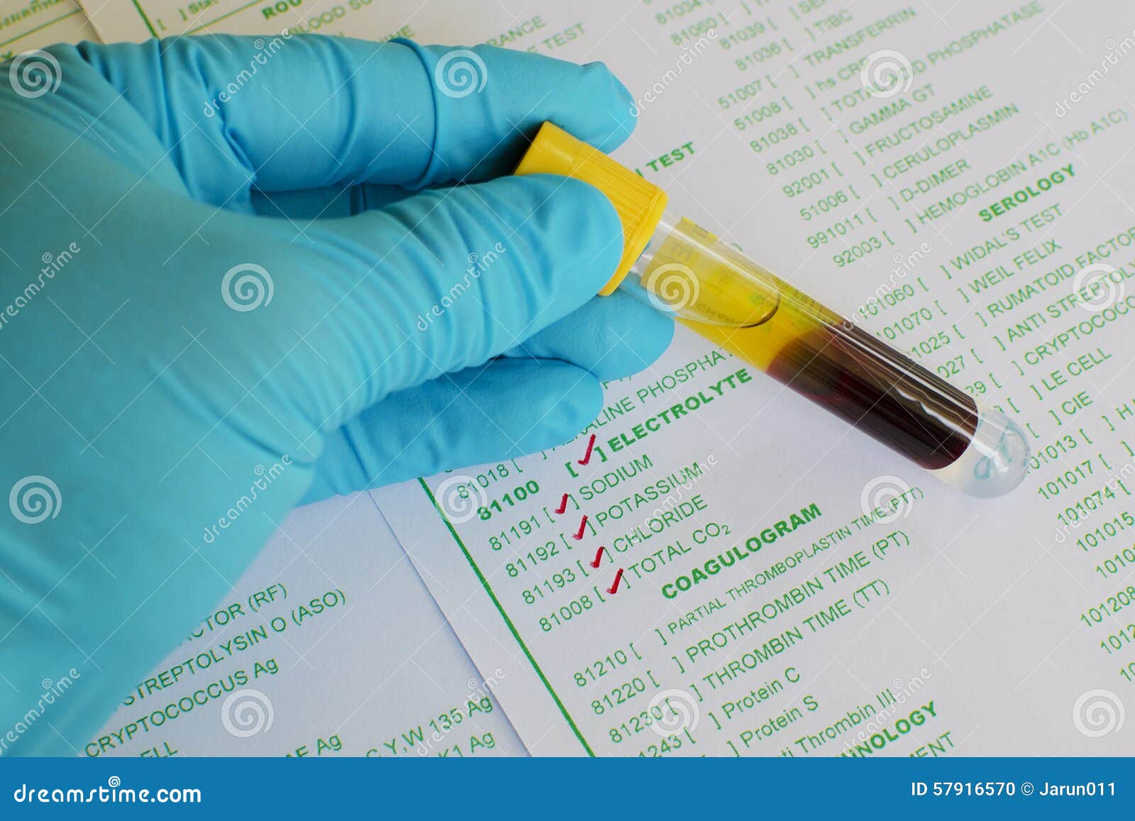Electrolyte testing stock photo. Image of research, science 57916570