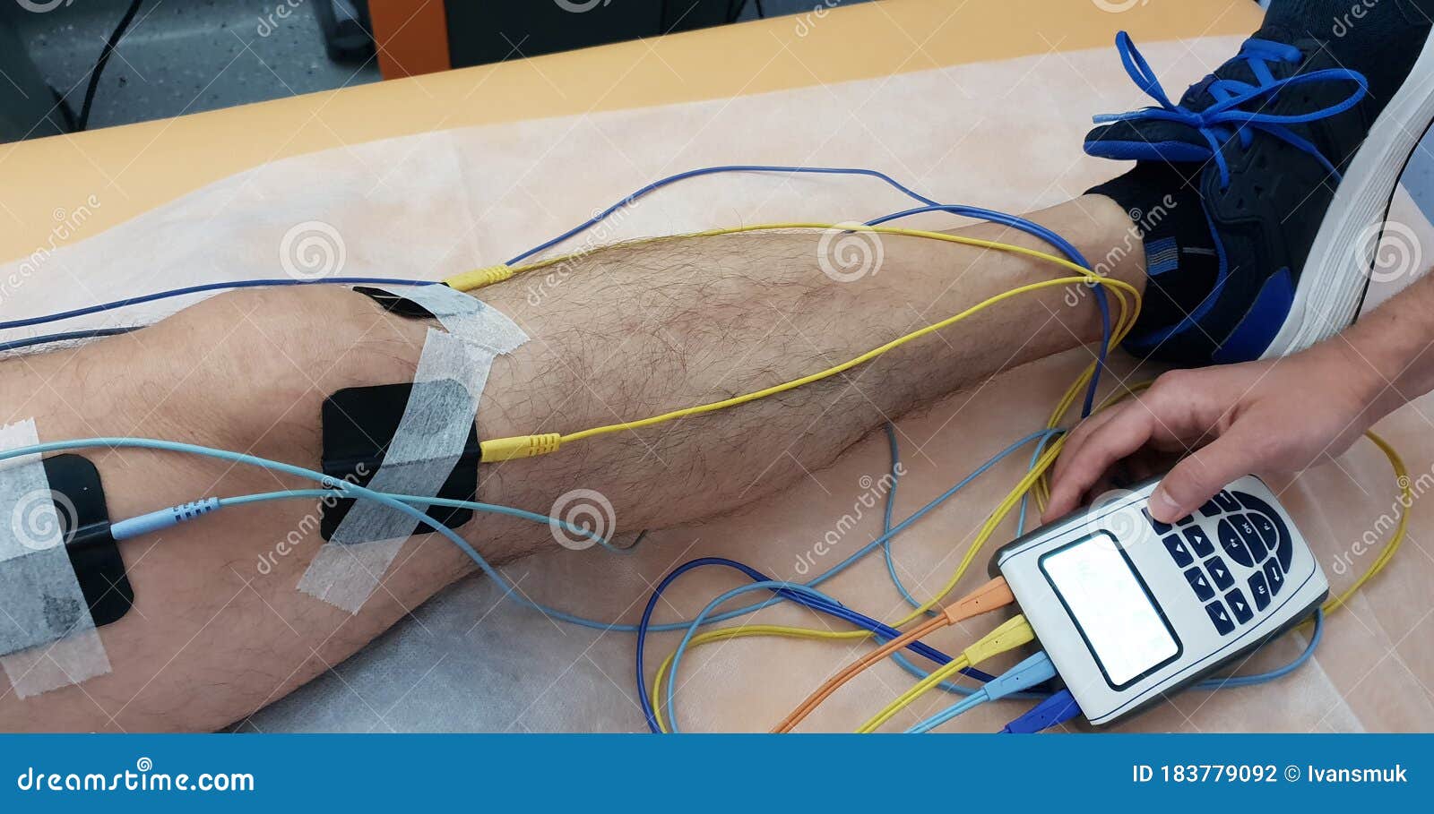 Electrostimulation of the Quadriceps As a Physiotherapy Stock Photo