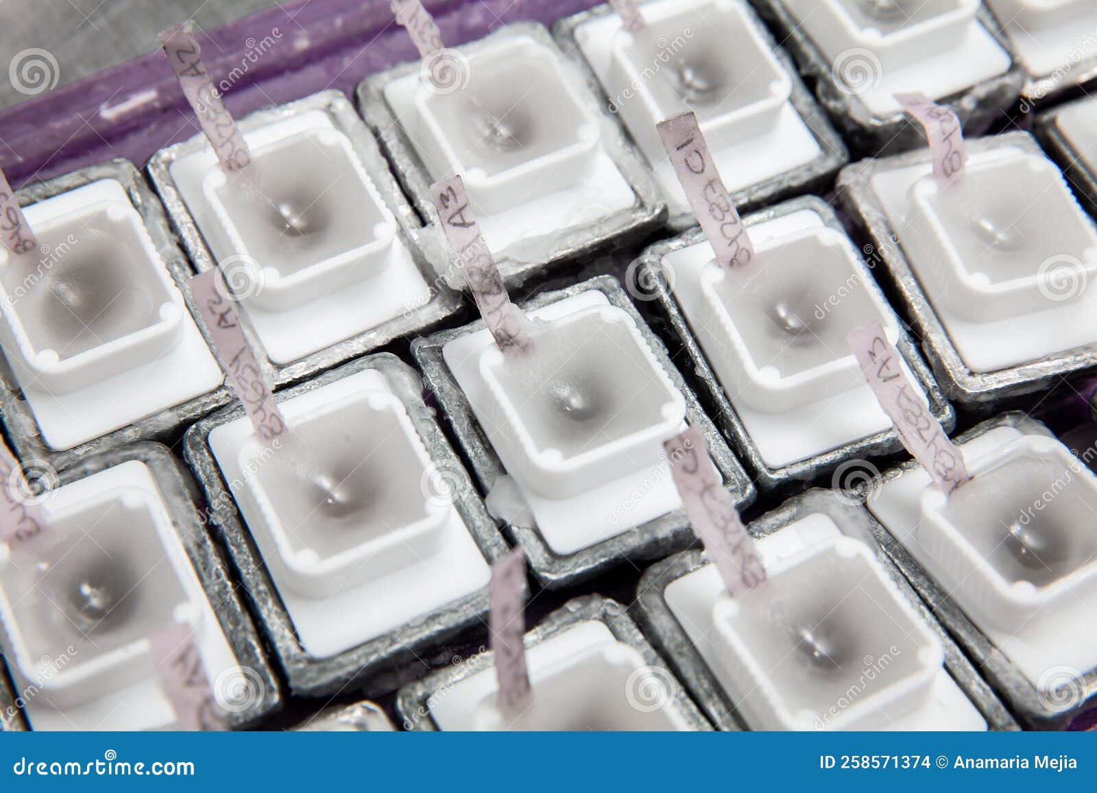 embedded tissues in paraffin blocks for sectioning. pathology laboratory. cancer diagnosis