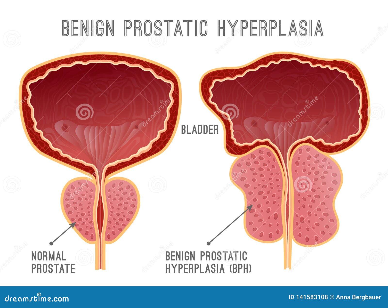 urolog prostata