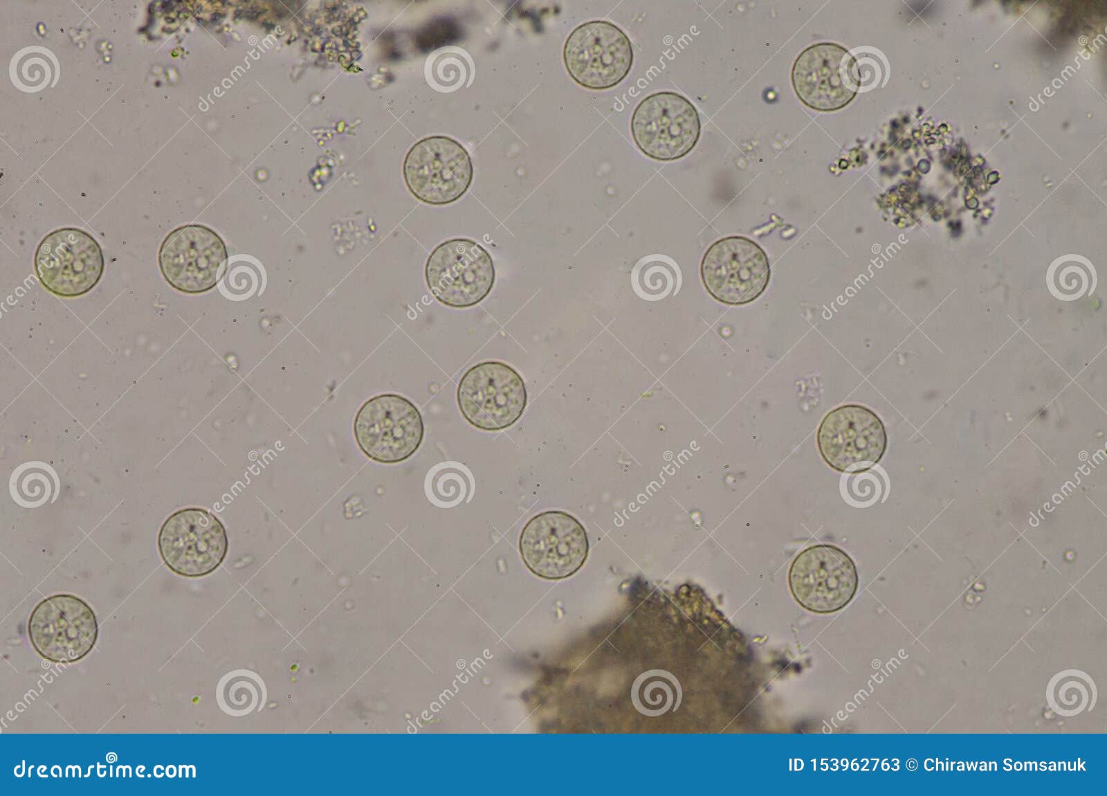 Entamoeba coli cysts stage in stool exam. Entamoeba coli protozao cystsstage in stool exam