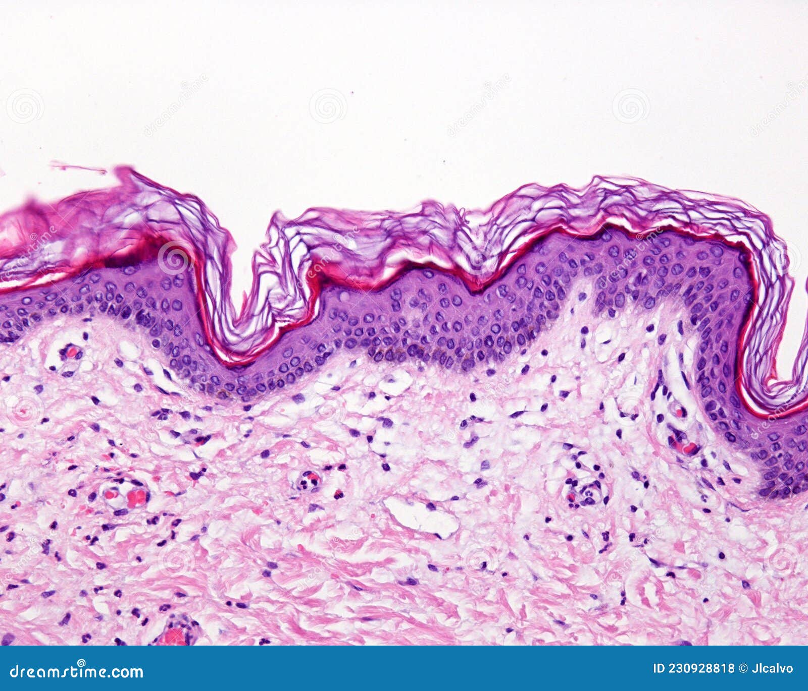 thin skin. hematoxylin-eosin