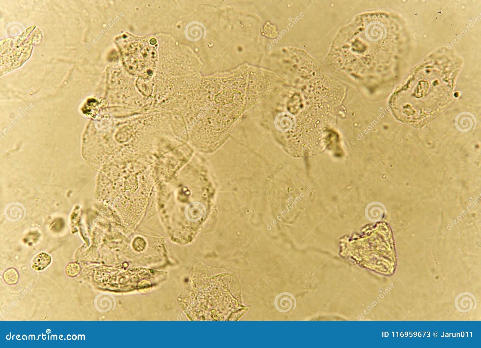 Epithelial Cells In Urine Under Microscope - Micropedia
