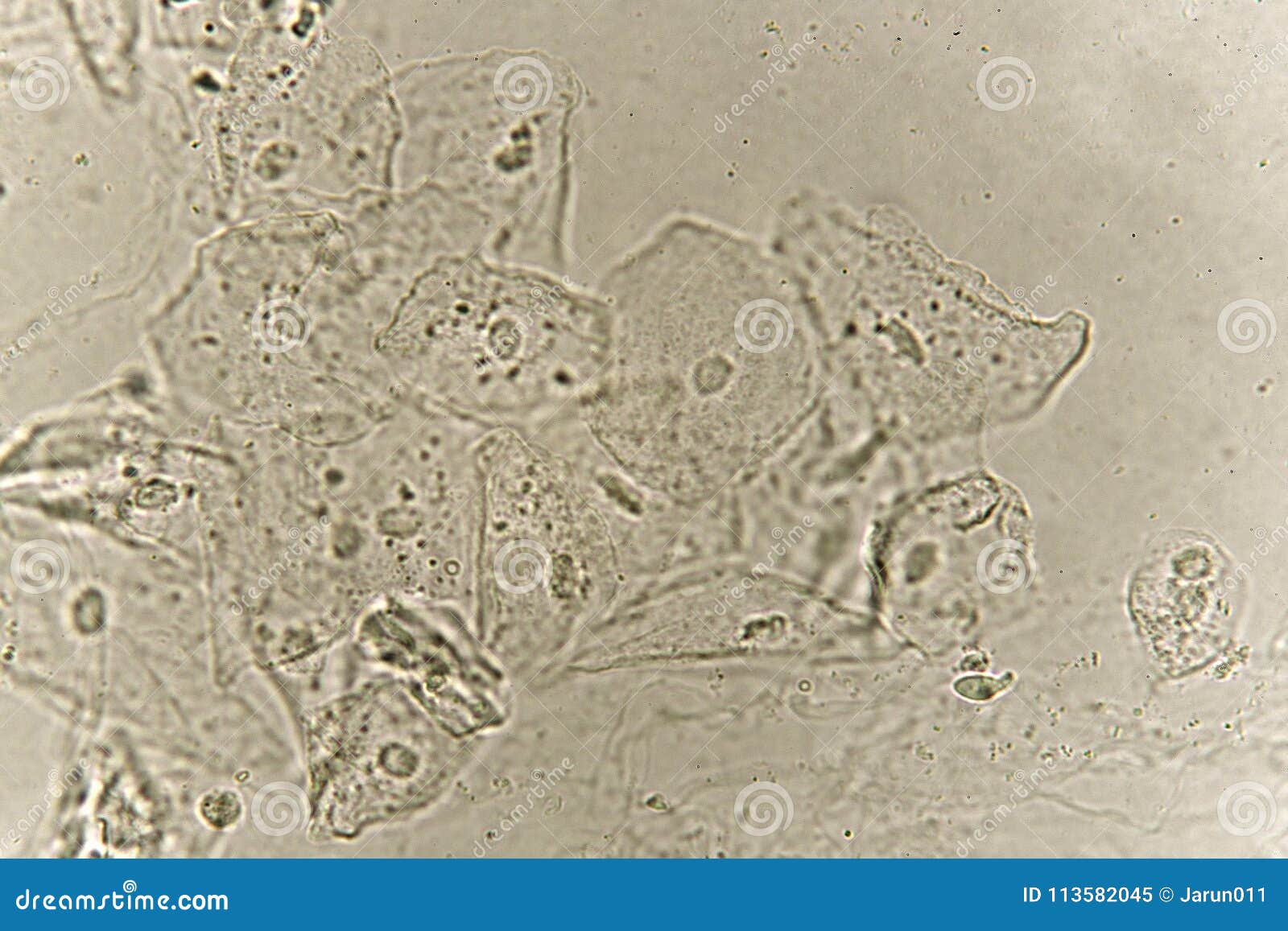 Microscope Transitional Epithelial Cells In Urine - Micropedia
