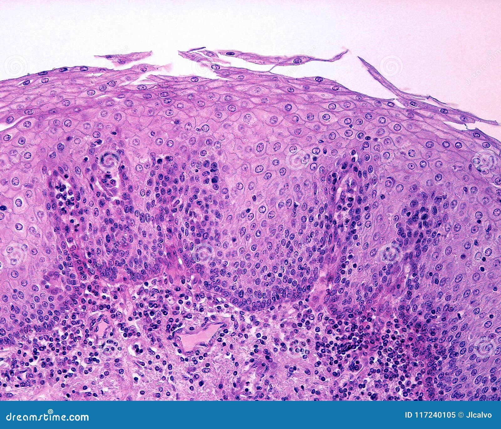 epithelium of esophagus