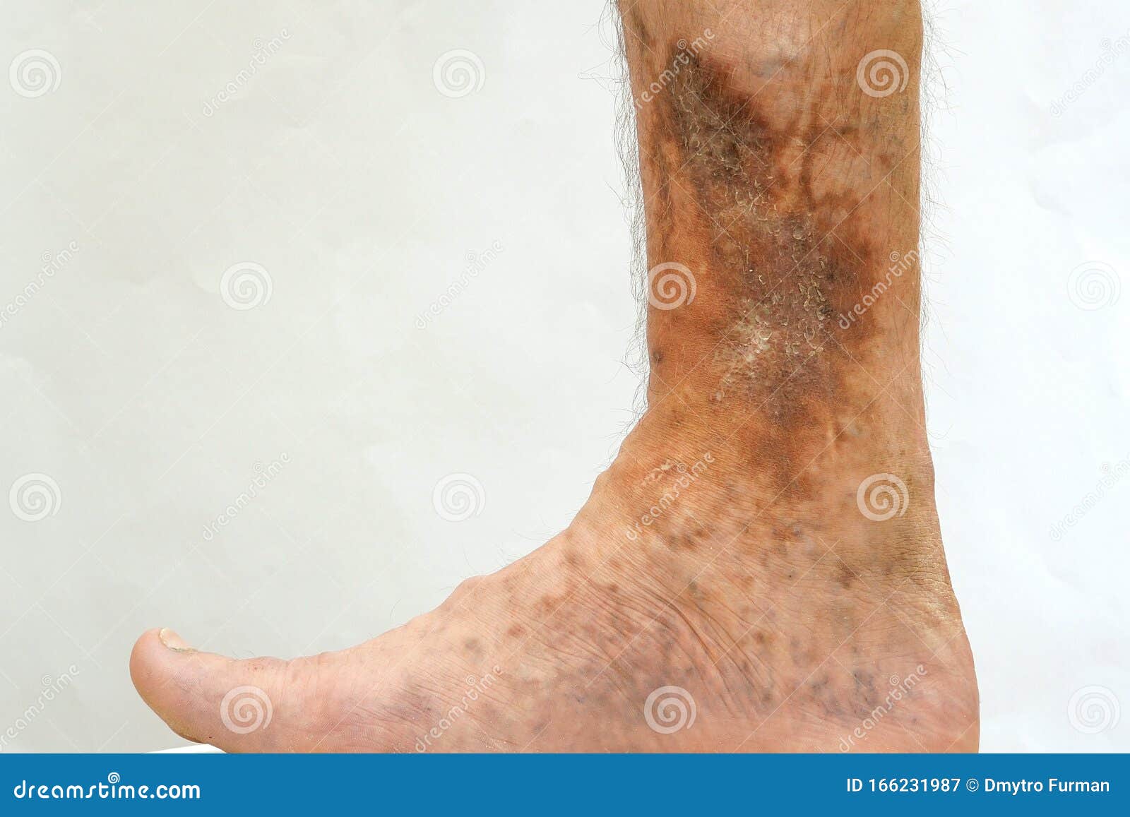 Mensch hautkrankheiten Haut: Warum