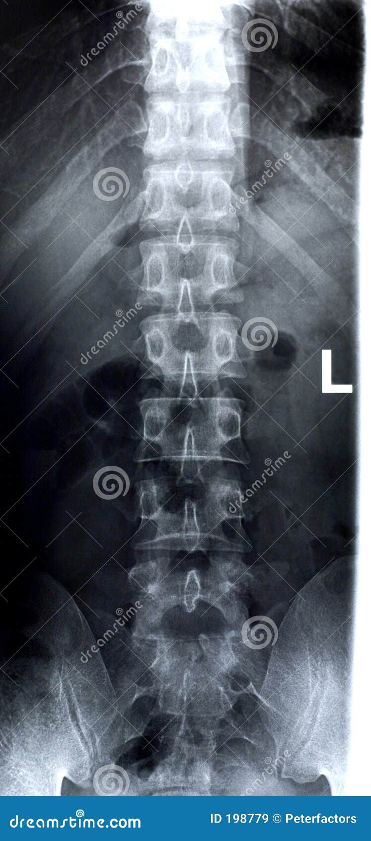 Coluna lombar/Frente imagem de stock. Imagem de anatomia - 198779, image size:747x1690