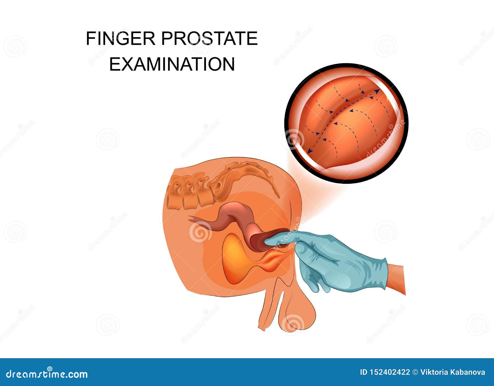 urolog prostata