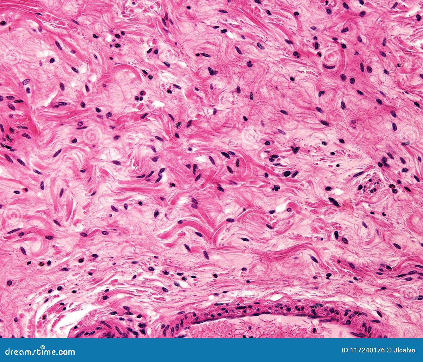 Connective Tissue Light Micrograph Royalty Free Stock Image connective-tissue-light-micrograph-royalty-free-stock-image