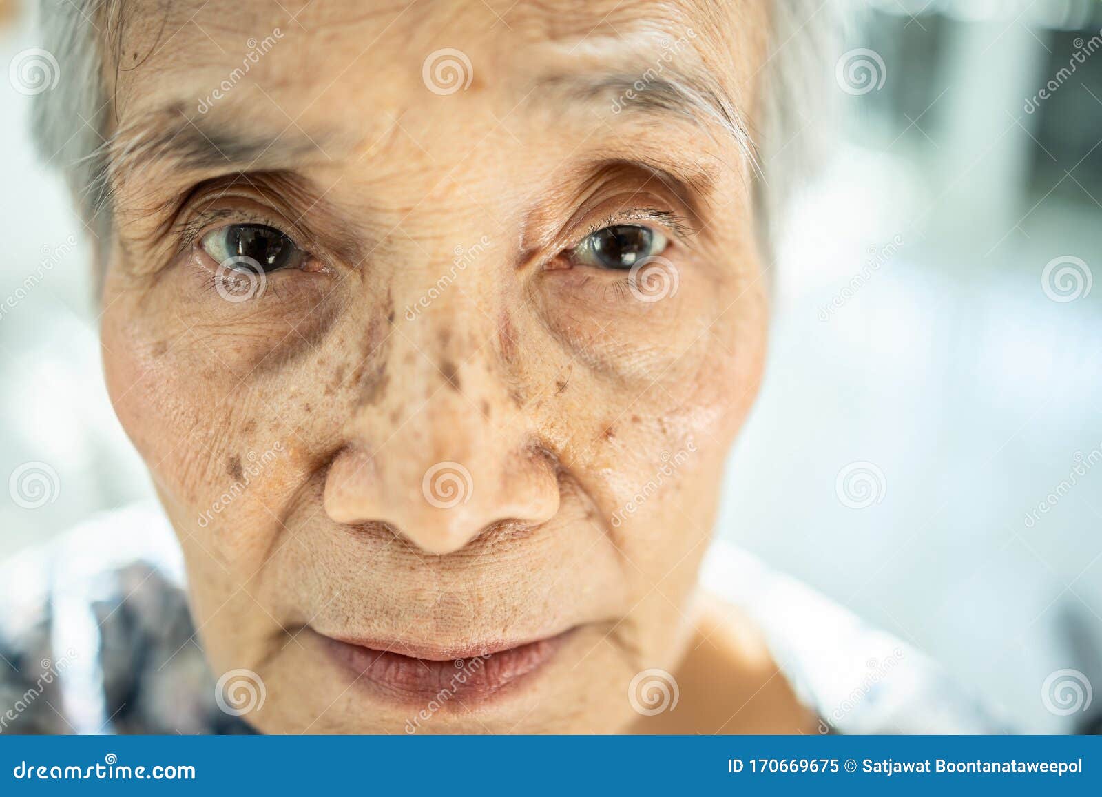 exhausted asian senior woman suffering from insomnia,.chronic insomnia or allergies causing her sunken eye, dark circles, blear