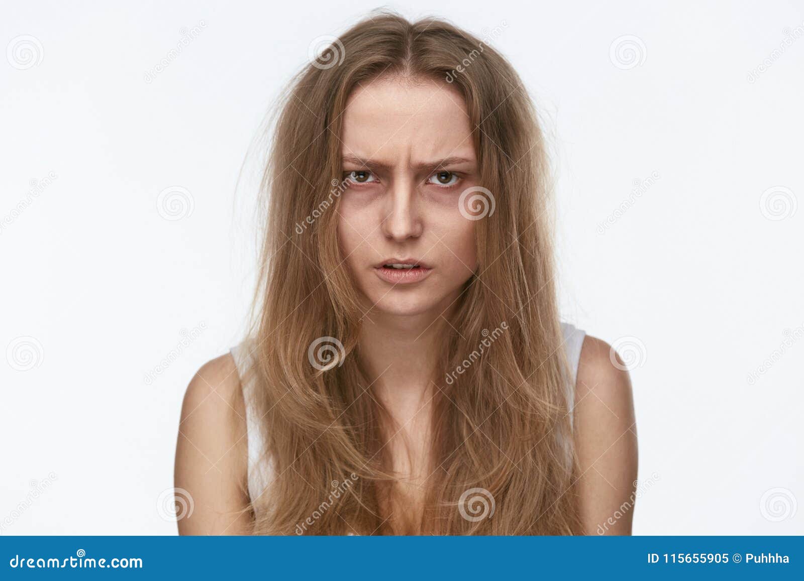 exhausted young woman with bruises under eyes