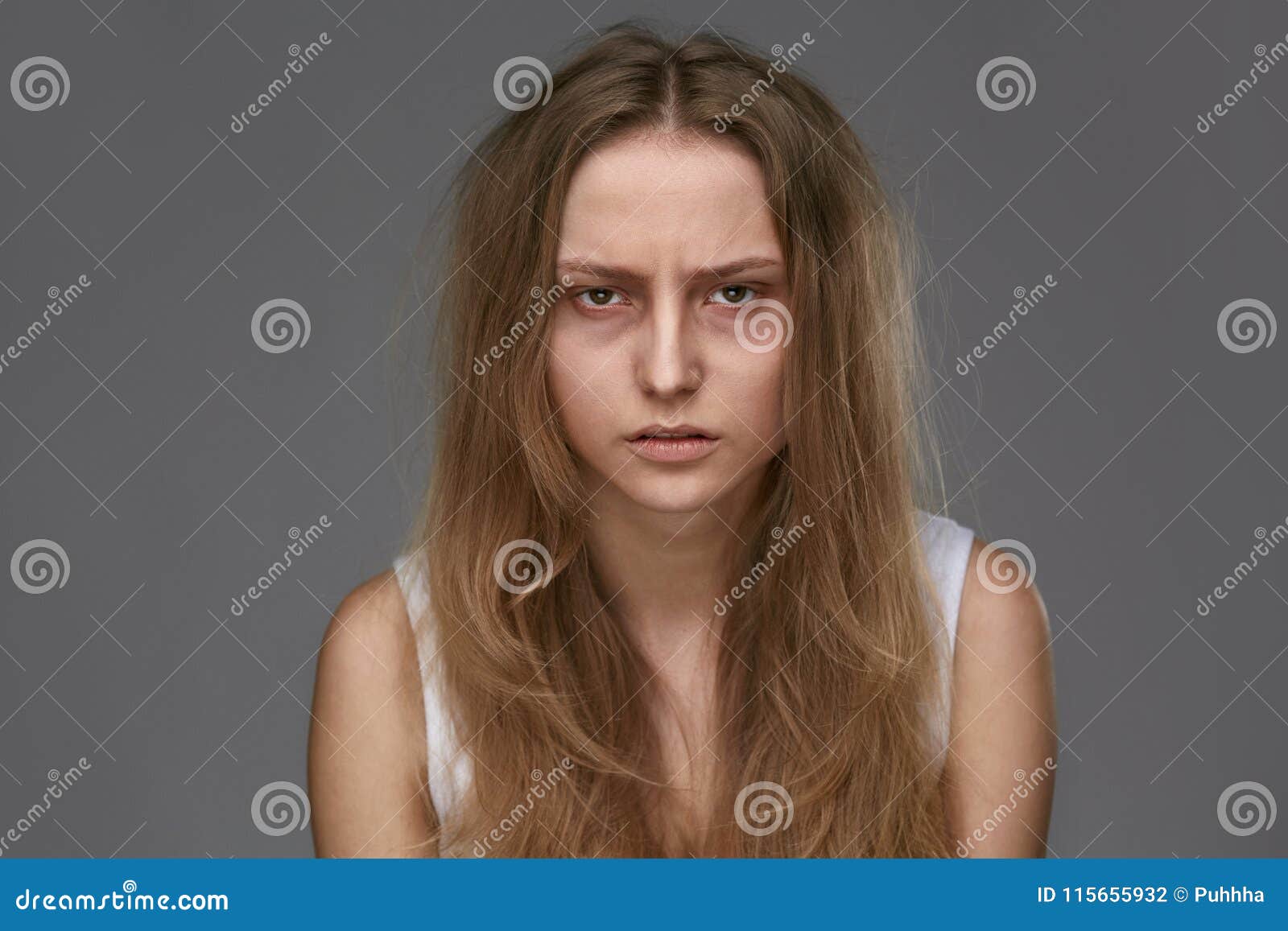 exhausted young woman with bruises under eyes
