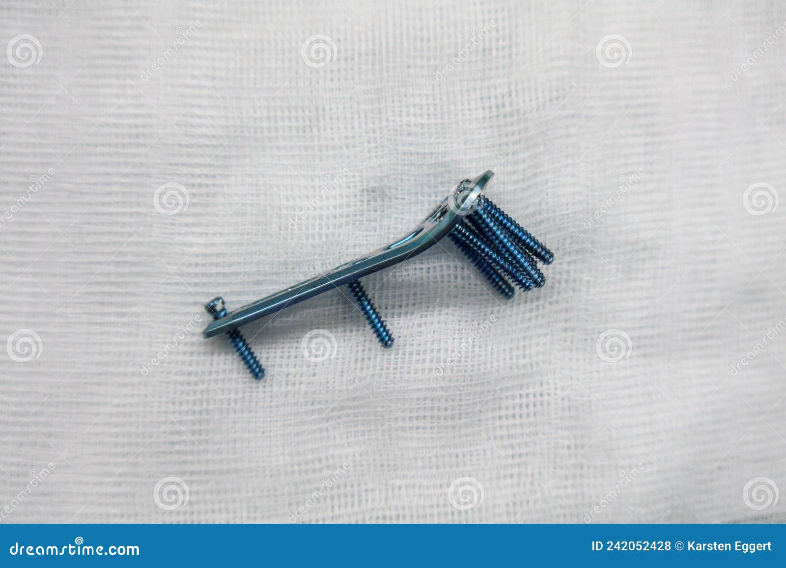 Explanted Surgical Blue Titanium Radius Plate Lies on a White Compress
