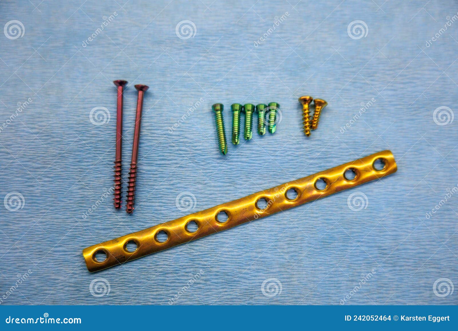 Explanted Titanium Surgical Tube Plate and Titanium Screws of