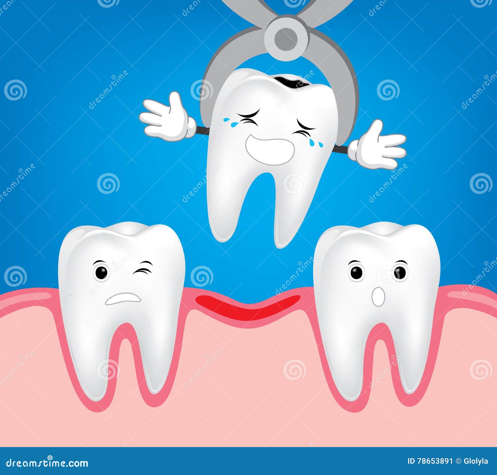 Extracción Dental Del Diente, Retiro Del Diente Ilustración del Vector