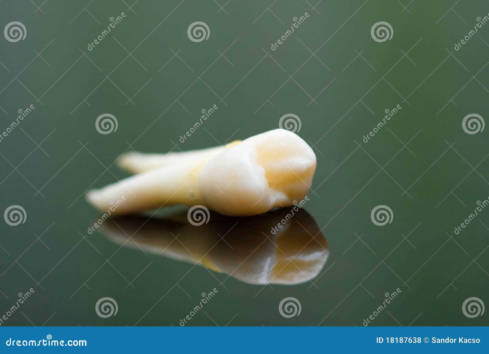 extracted tooth