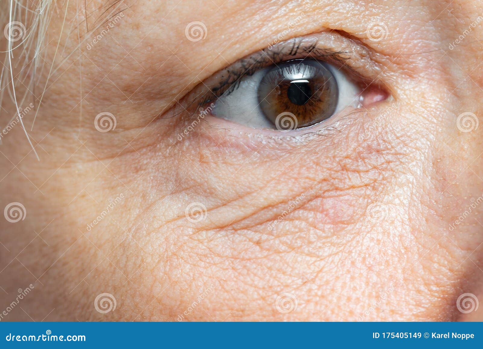 macro detail of under eye wrinkles on middle aged woman