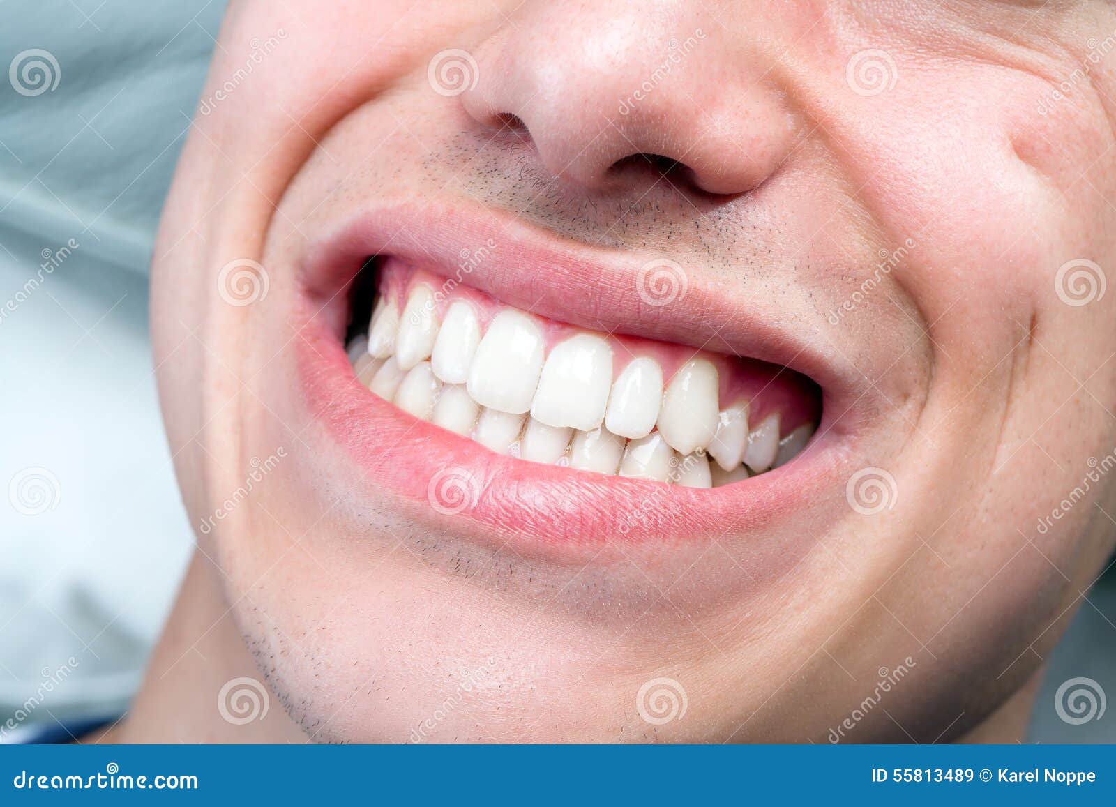 extreme close up of human male mouth showing teeth.