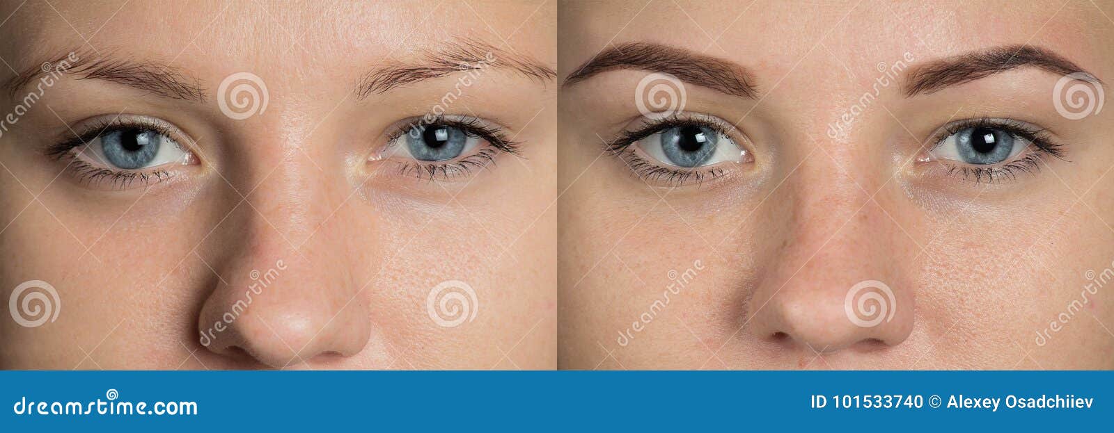 eye brows before after correction