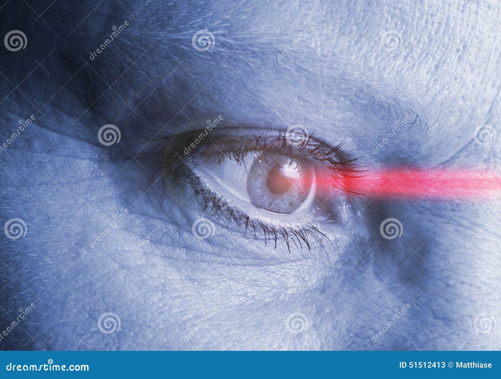 Eye laser operation stock image. Image of doctor, eyesight 51512413