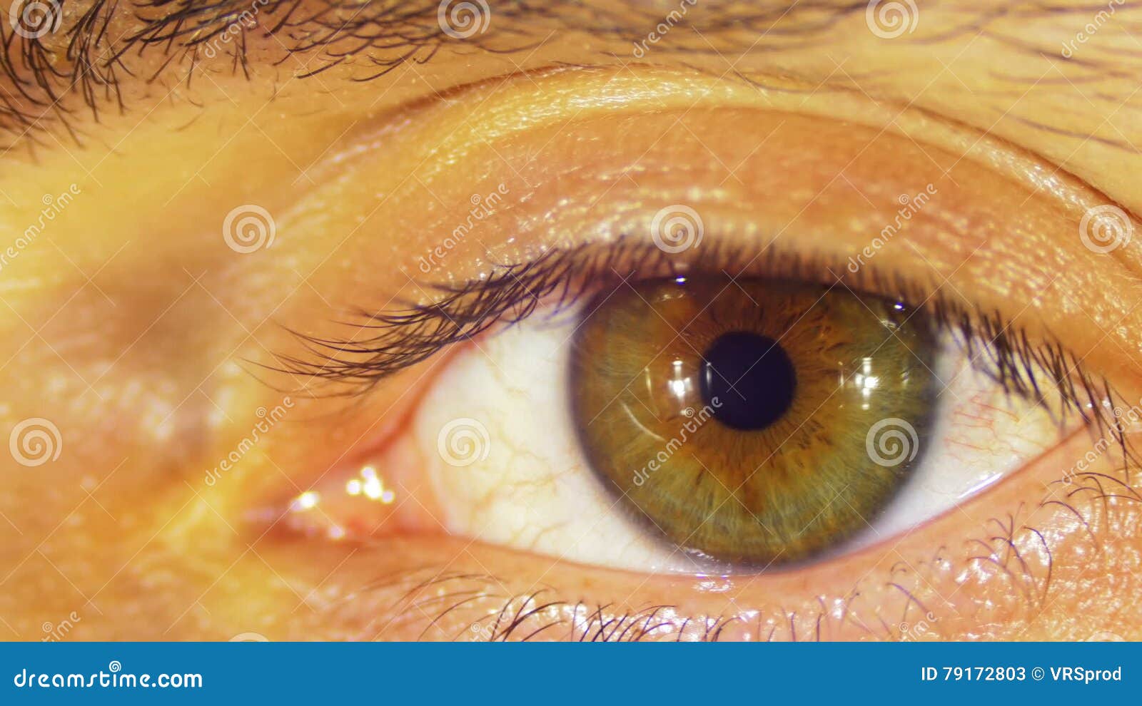 Как выглядят вспышки в глазах Visual Migraine Animation YouTube