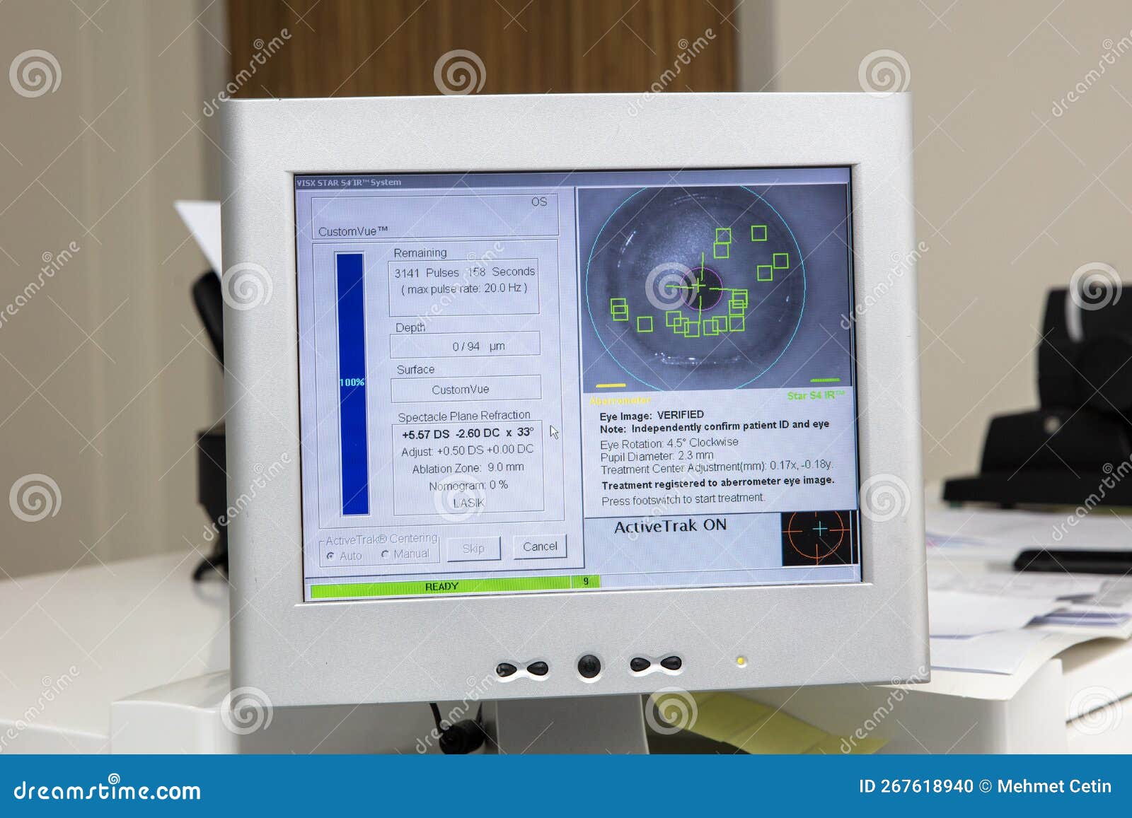 Eye Surgery Process, Treatment of Cataract and Diopter Correction