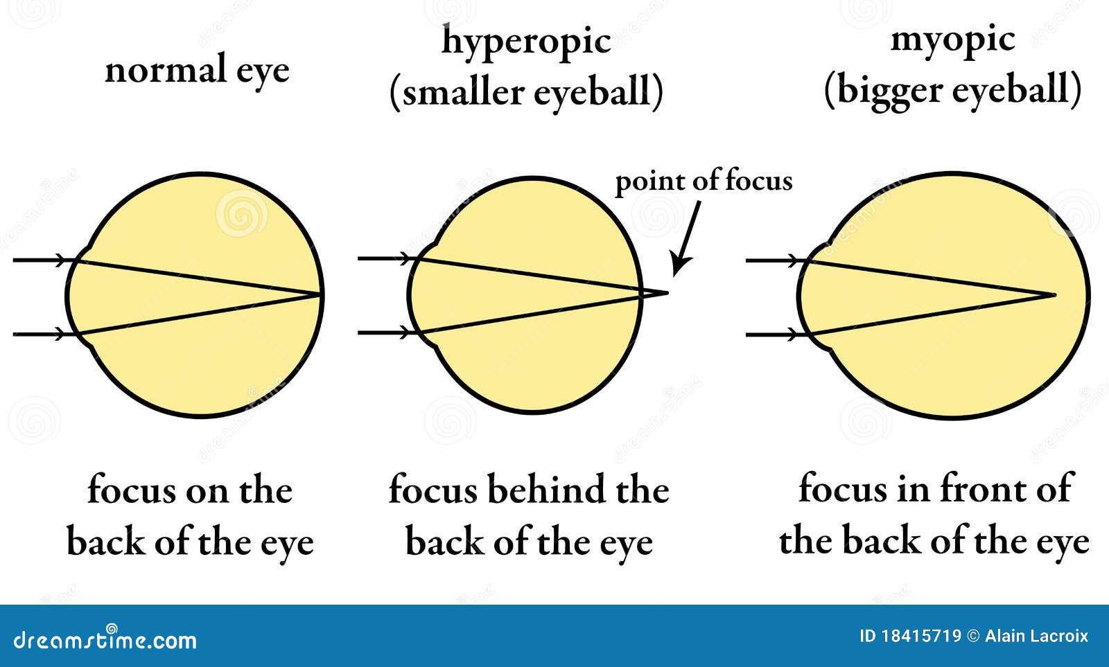 Eyesight Cartoons Illustrations Vector Stock Images 77738 Pictures eyesight-cartoons-illustrations-vector-stock-images-77738-pictures