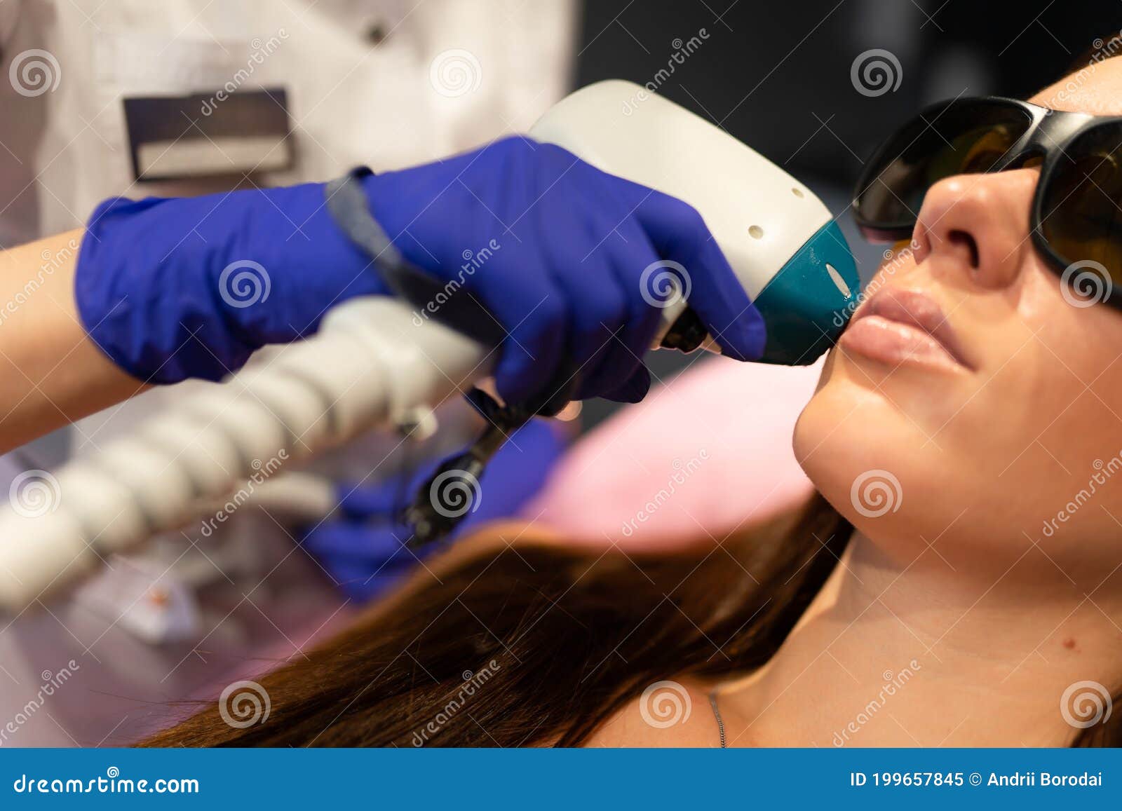 Face Laser Hair Removal Procedure. Stock Image Image of cosmetology