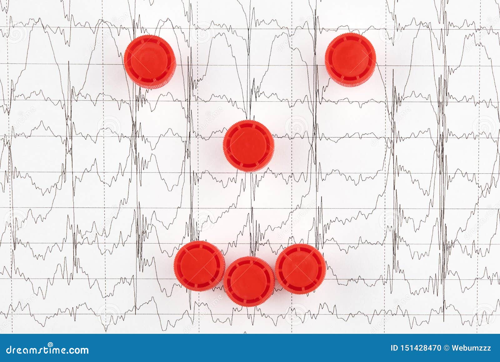 heart faces on ekg heart faces on ekg