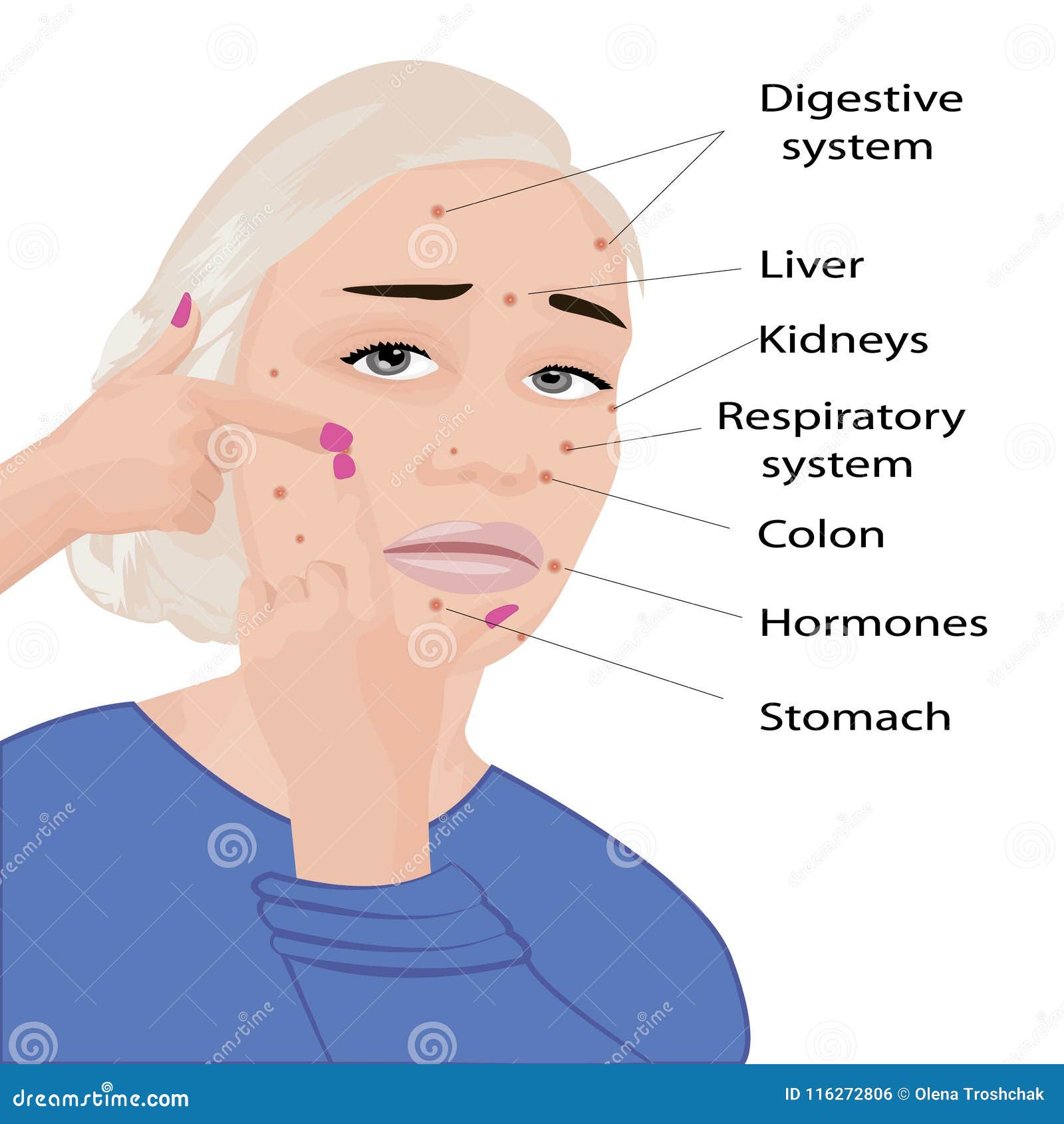 Face Mapping. What Your Acne Telling You Infographic Stock Vector