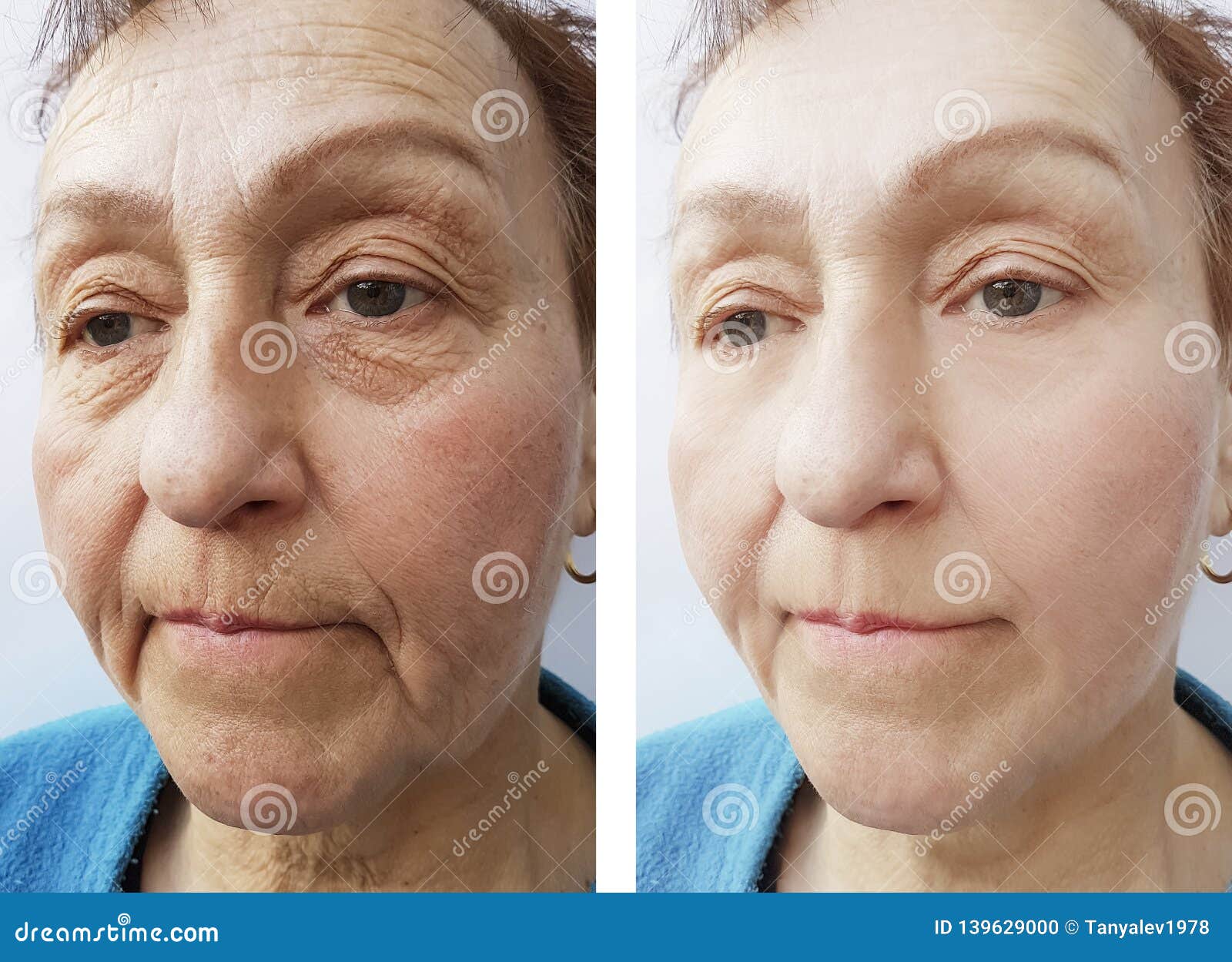 亚洲老年妇女面部皱纹皮肤的特写镜头。高清摄影大图-千库网