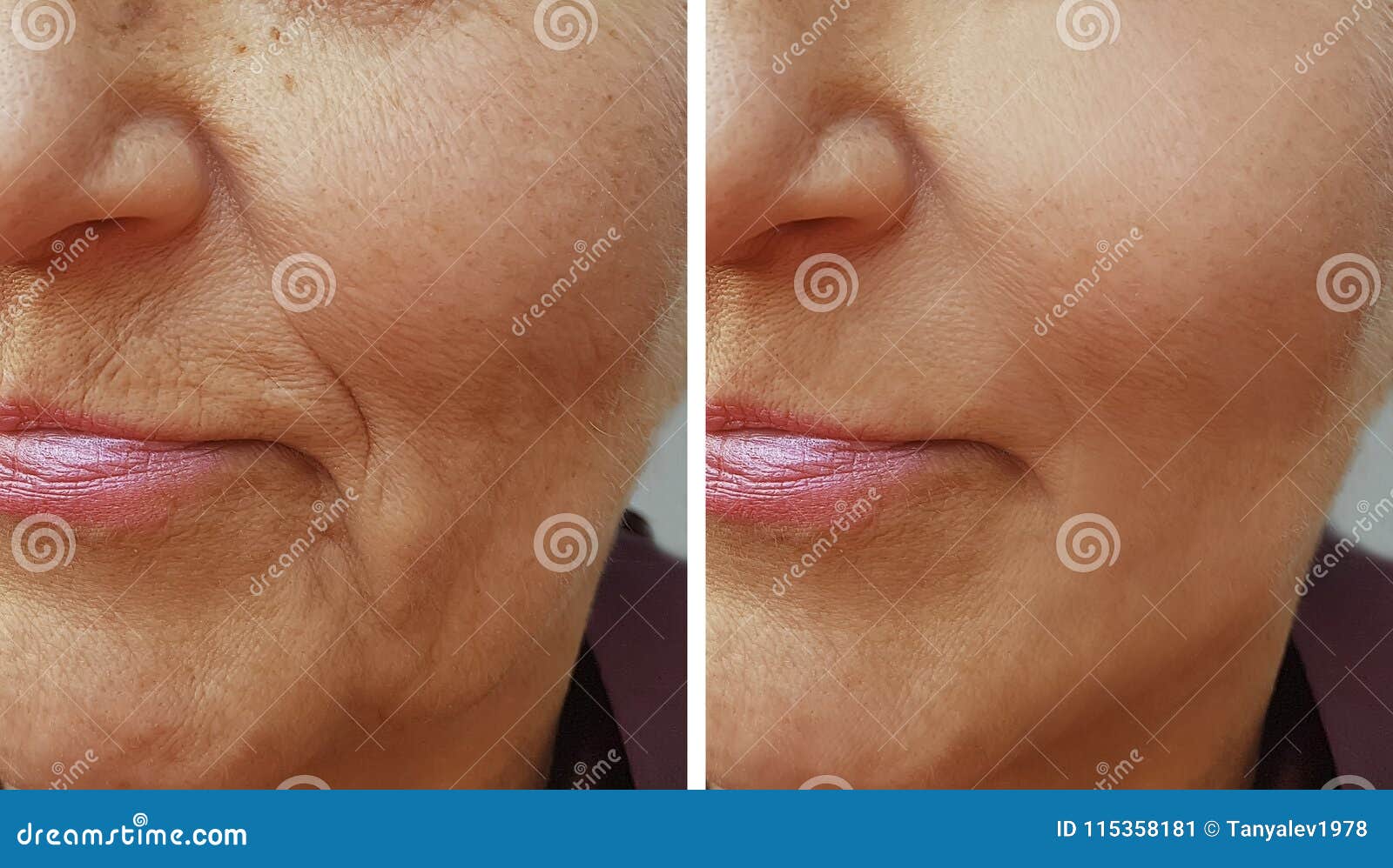 face of an old wrinkle woman before and after