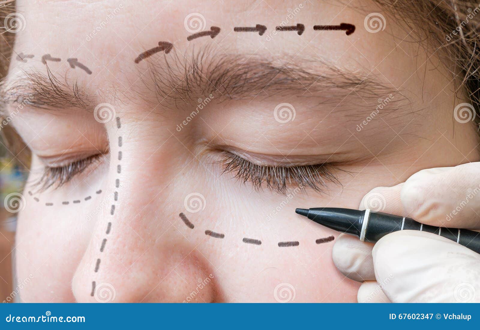 Facial Plastic Surgery. Hand is Drawing Lines with Marker Around Eye