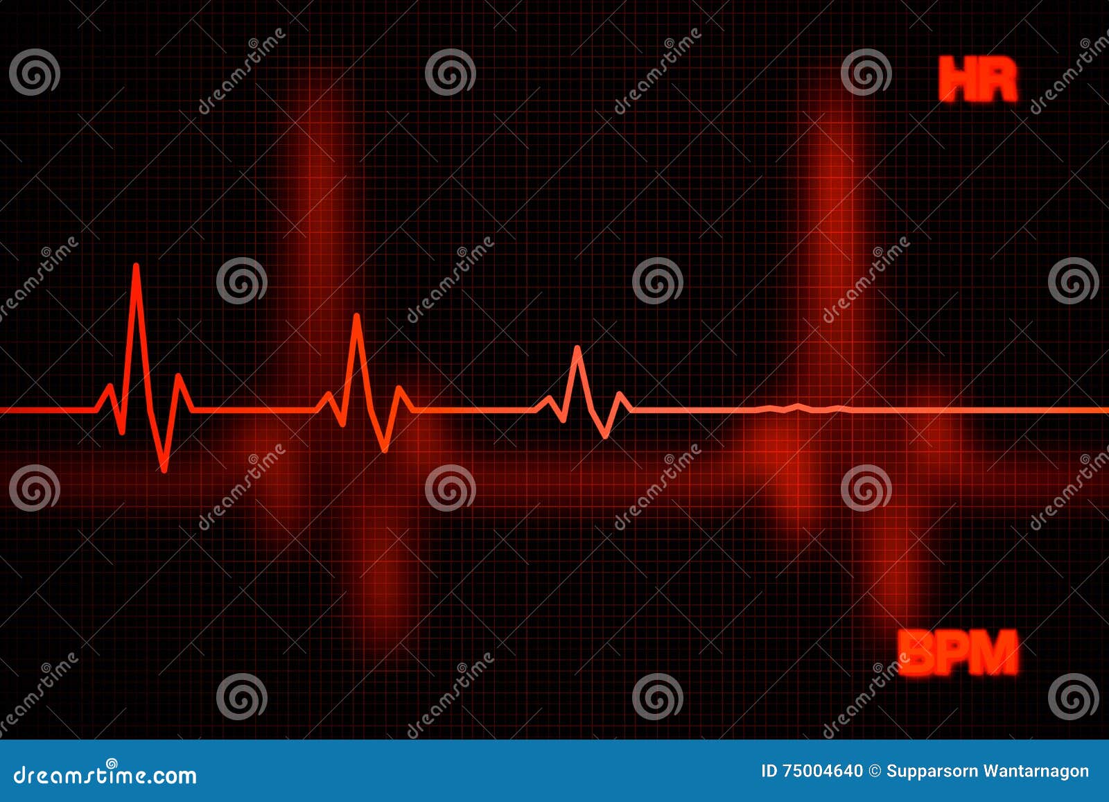 failure heart rate graph background