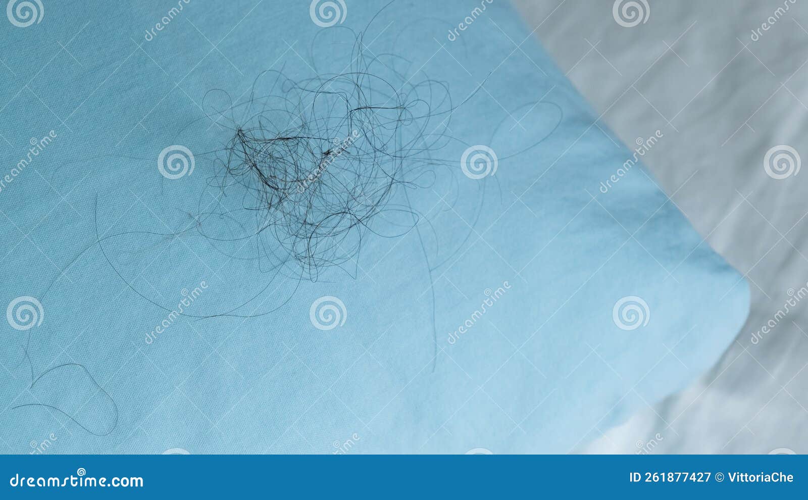 Fallen Long Hair on the Blue Pillow. Baldness Problem Stock Image