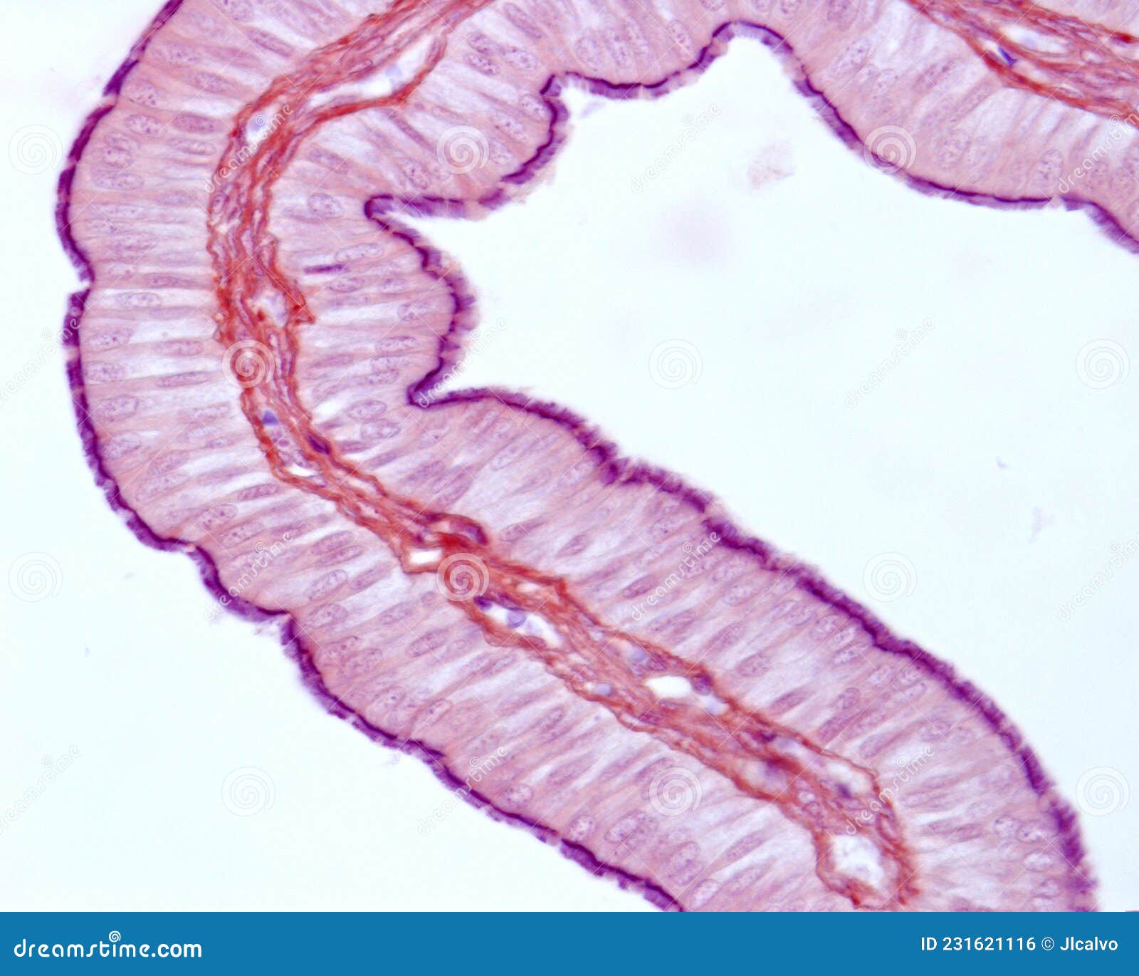 Fallopian Tube Ciliated Epithelium Royalty Free Stock Image fallopian-tube-ciliated-epithelium-royalty-free-stock-image