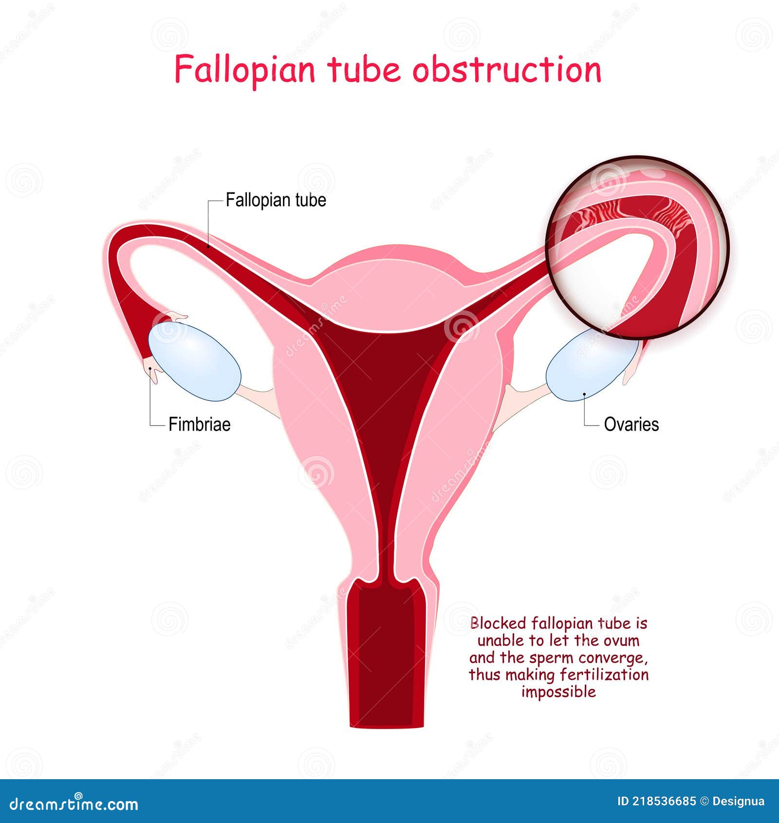 Close Tube