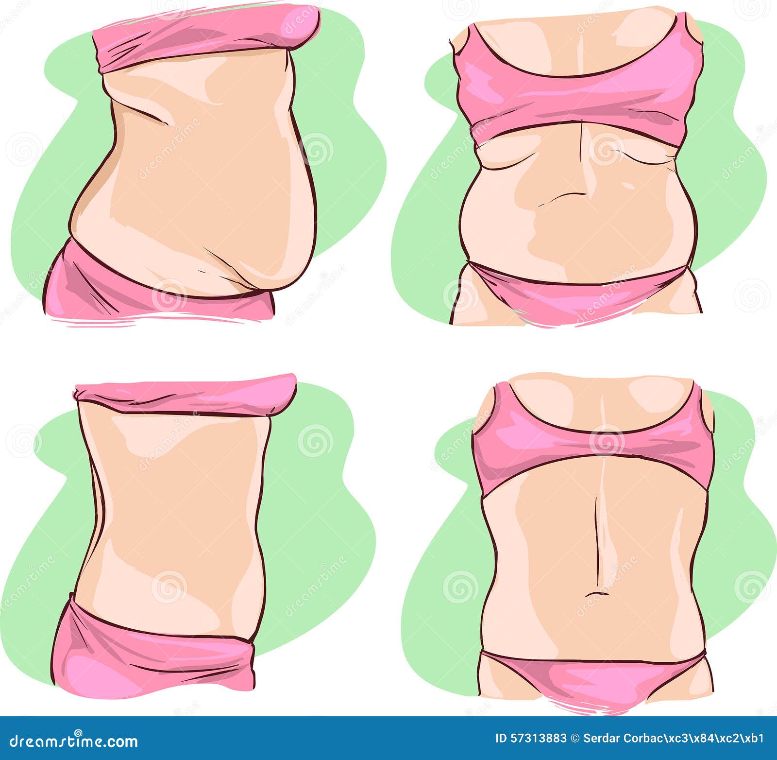 fat belly before and after treatment.