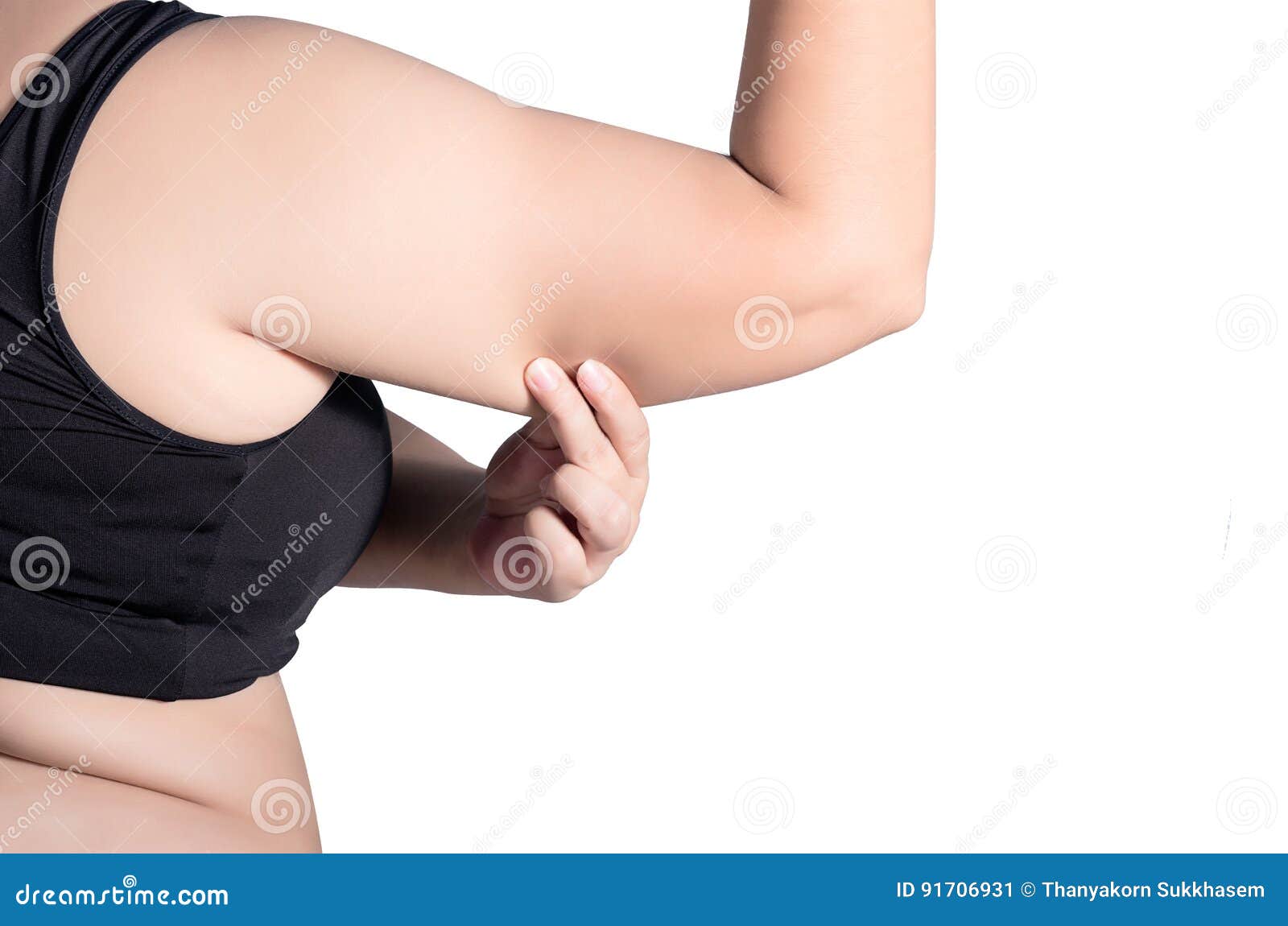Fat Overweight Woman, Show Big Arms with Fat Accumulation, on White  Background., Need Lose Weight Accelerate Burn Fat Excess, Die Stock Image -  Image of diet, dieting: 91706931