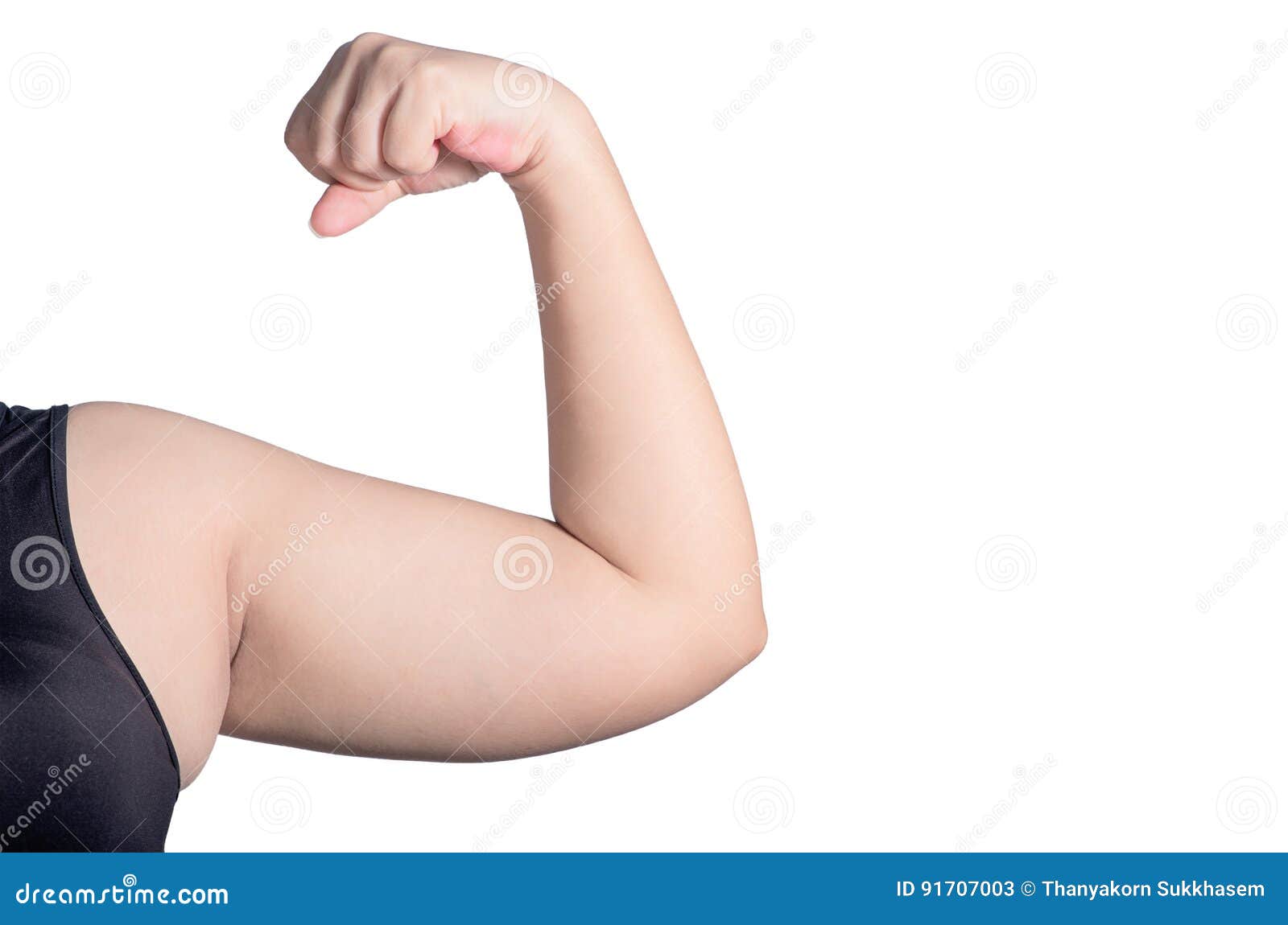 Fat Overweight Woman, Show Big Arms with Fat Accumulation, on