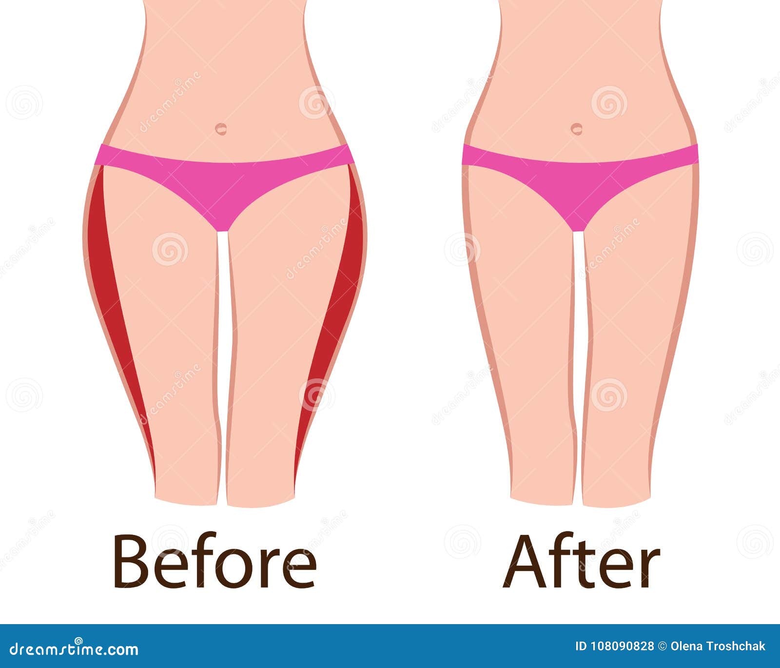 Fat and Slim Girls` Hips. before and after Stock Vector