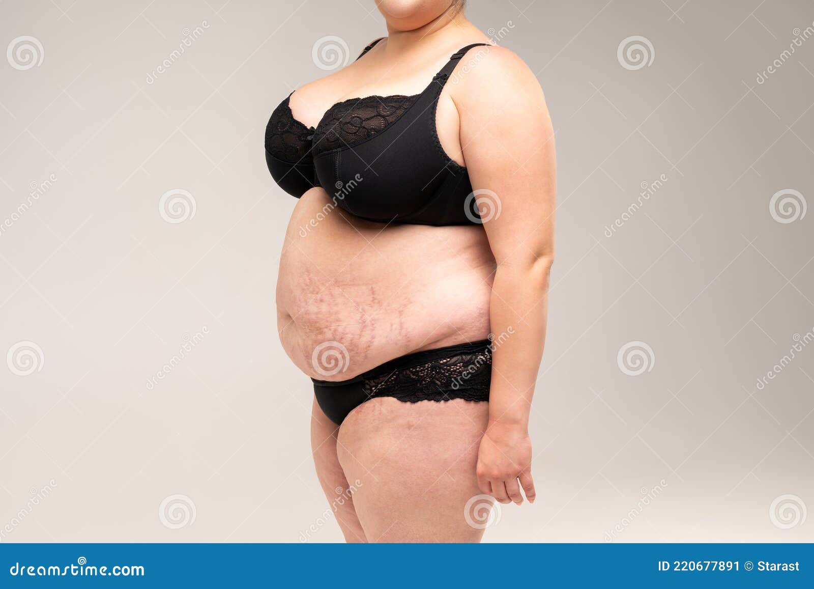 Morbidly obese people in lingerie 304 Obese Woman Lingerie Photos Free Royalty Free Stock Photos From Dreamstime