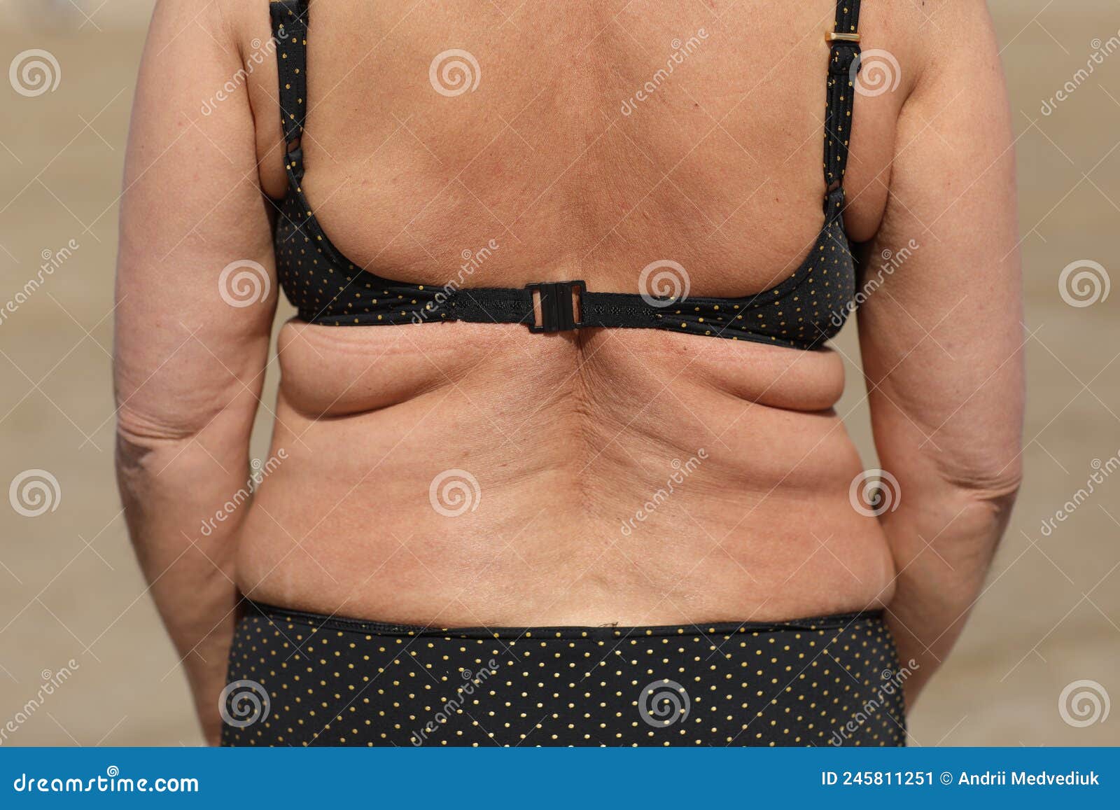 Woman Belly Fat Hanging Over Jeans Stock Photos - Free & Royalty-Free Stock  Photos from Dreamstime