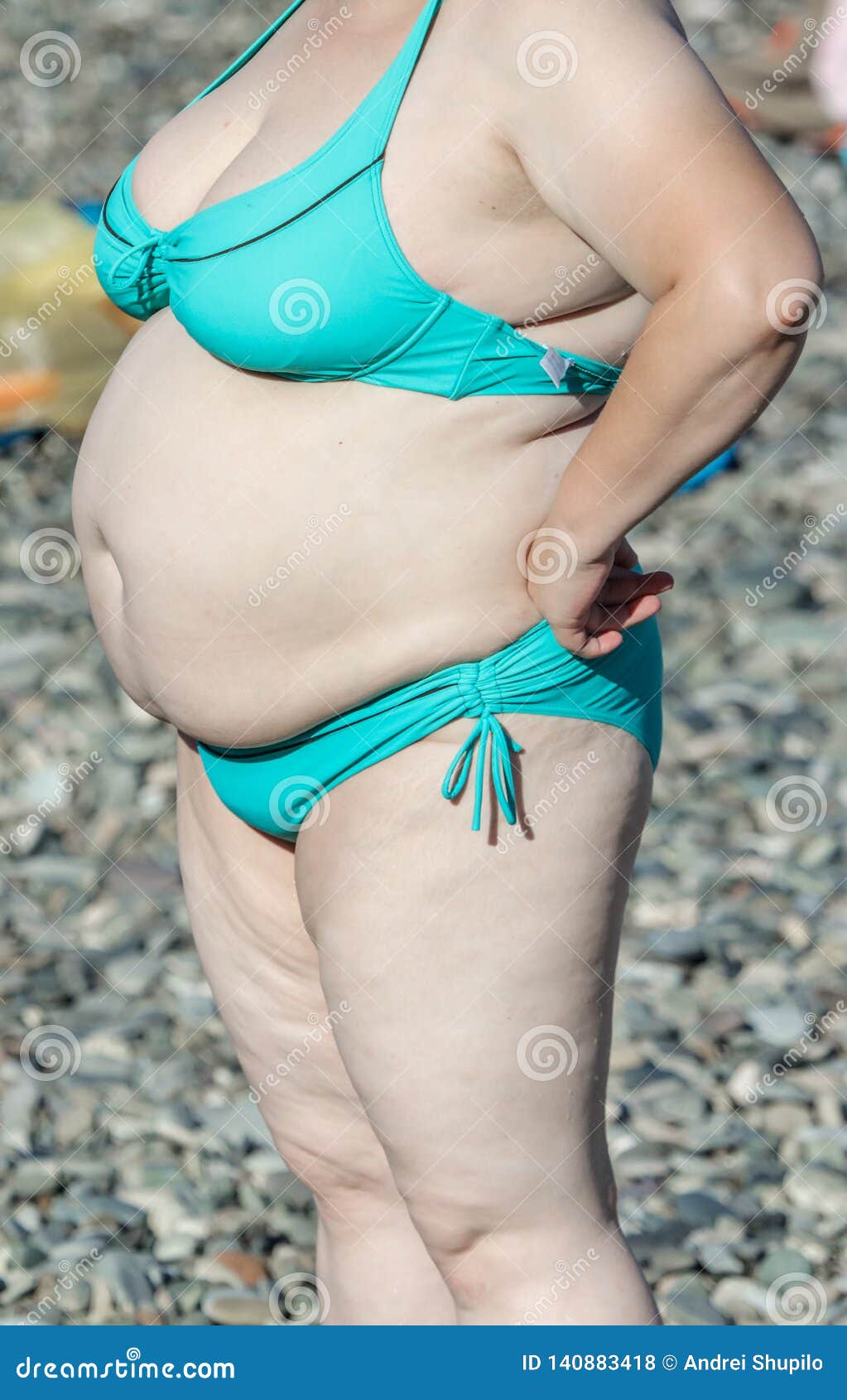 Fat Lady In A Bikini